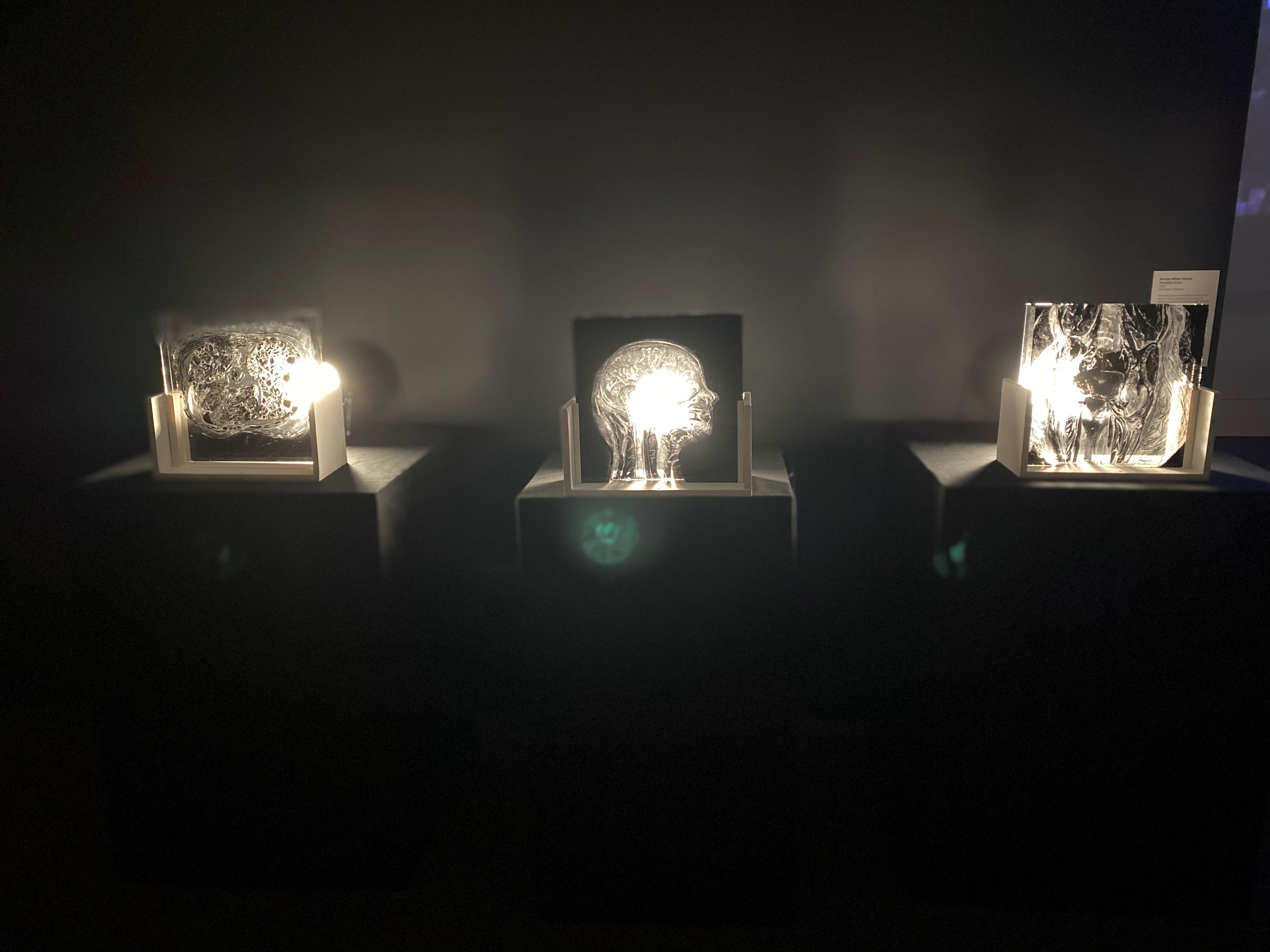 Art pieces depicting 3 illuminated scans of people with invisible illnesses