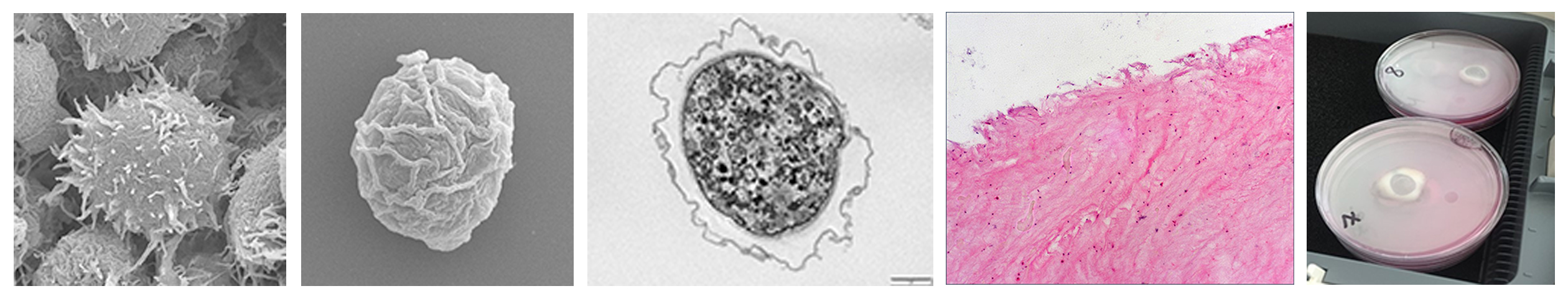 Images illustrating research in communicable disease and infection control